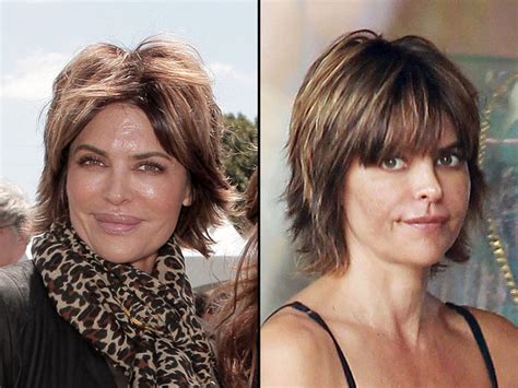 Lisa Rinna Lips Before And After