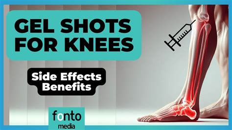 7 Key Insights Into Gel Shots For Knees Side Effects Benefits