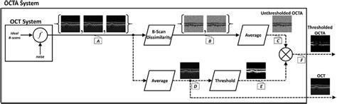 Detailed Flowchart Of Octa Processing Repeated Bscans Block A Are Download Scientific