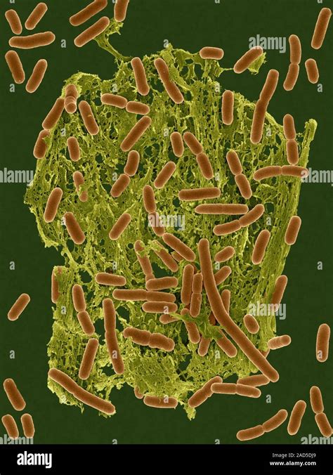 Color Análisis Micrografía De Electrones Sem De Escherichia Coli