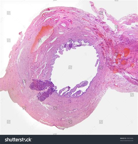 Human Fallopian Tube Cross Section Magnification Stock Foto 43653406