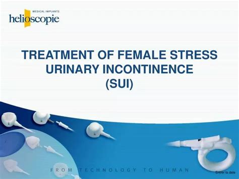 Ppt Treatment Of Female Stress Urinary Incontinence Sui Powerpoint