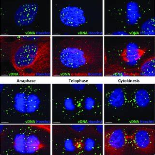 Representative Images Of The Intracellular Distribution Of Hpv