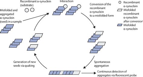 RT QuIC for detection of prodromal α synucleinopathies The Lancet