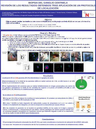 PDF BIOPSIA DEL GANGLIO CENTINELA REVISIÓN DE REVISIÓN DE LOS