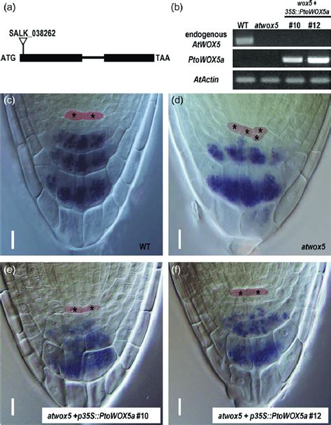 Complementation Of The Arabidopsis Wox5 Mutant With Ptowox5a A