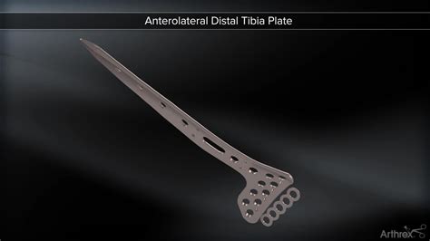 Arthrex Anterolateral Distal Tibia Plate