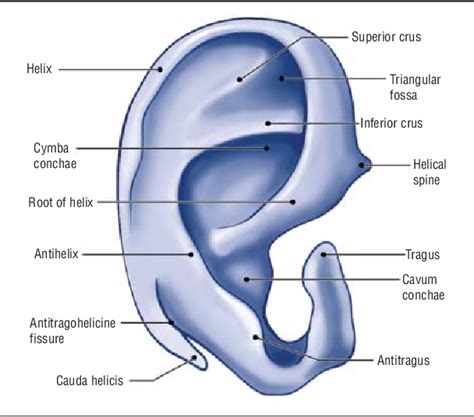 Figure 2 From Otoplasty Using A Modified Anterior Scoring Technique