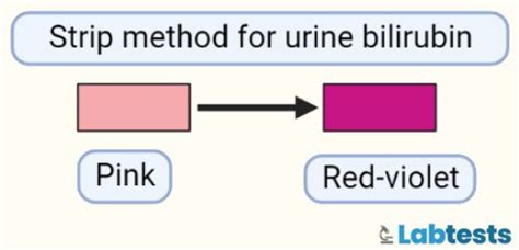 Blood Serum Bilirubin And Urine Bilirubin Tests Normal Range And