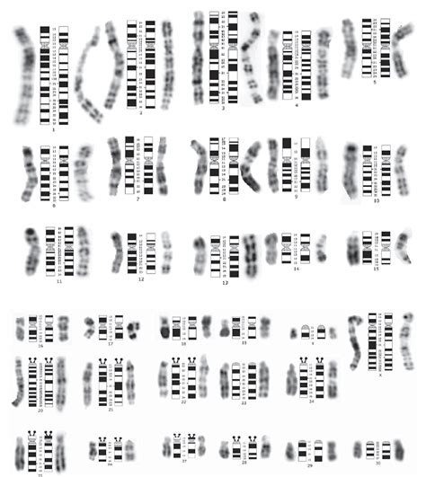 Figure 1 From The 450 Band Resolution G And R Banded Standard