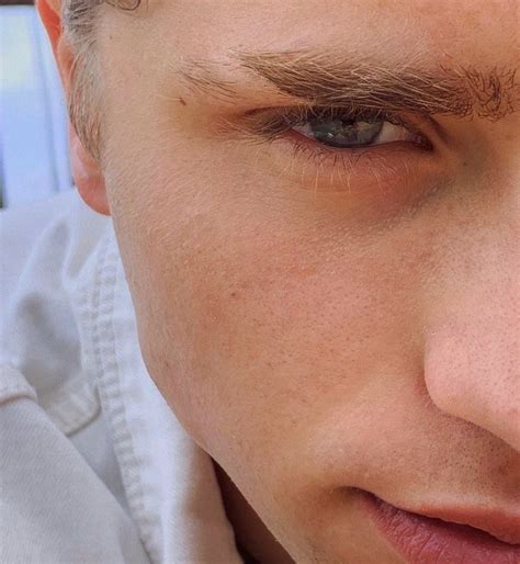 A Close Up Of A Person Wearing A White Shirt And Tie With His Eyes Open