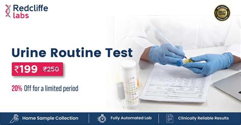 Urine Routine Test Urine R M Test Price Procedure Report