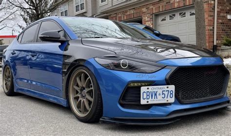 Elantra Sport Non Sport Carbon Fiber Fenders Socal Garage