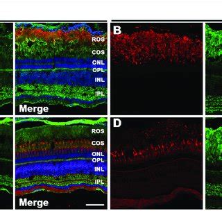 Immunolocalization Of Immune Cells In Zebrafish Retina Lacking Bbs