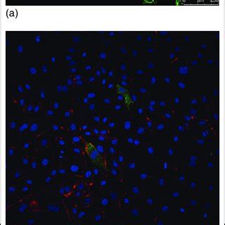 In Vivo In Vitro And In Silico Models For Angiogenesis A Fli A Egfp