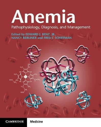 Anemia Pathophysiology Diagnosis And Management Original PDF From