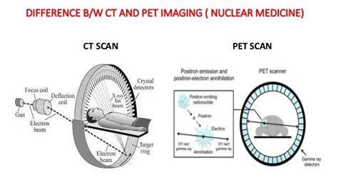 Nuclear medicine PET scan