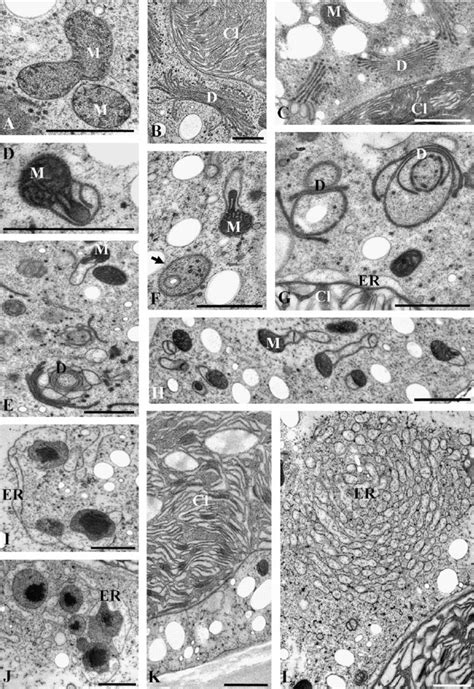 Tem Micrographs Showing Ultrastructure Of Control Cell A B Of Cells