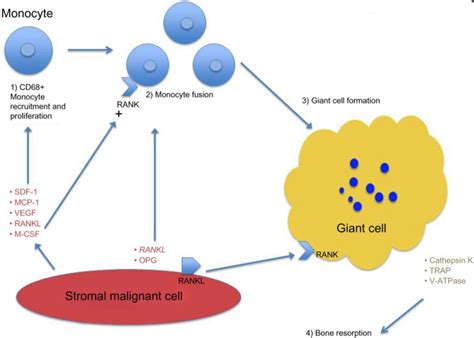 Giant Cell Tumor - Pathology - Orthobullets