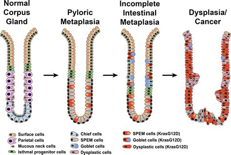 Spasmolytic Polypeptideexpressing Metaplasia SPEM Cell Lineages Can