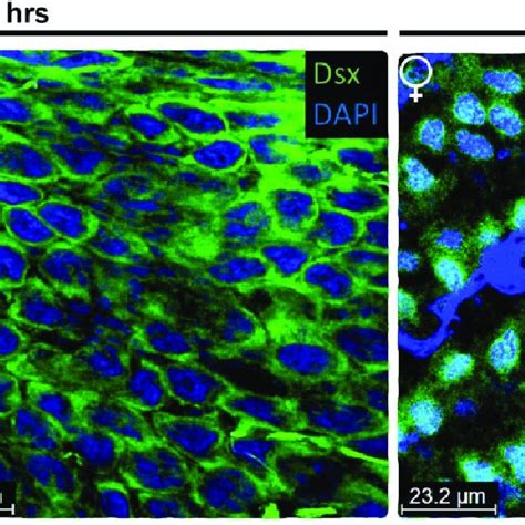 Dsx Spatial Expression During Zerene Cesonia Wing Development Dsx Download Scientific Diagram