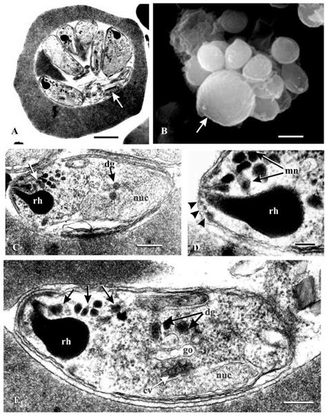 Electron Micrographs Showing Developing Merozoites In Late Stages Download Scientific Diagram