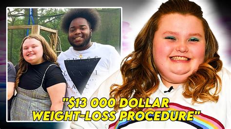 Honey Boo Boo And Boyfriend To Undergo Weight Loss Procedure Youtube