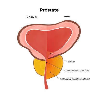 Prostate Gland Anatomy