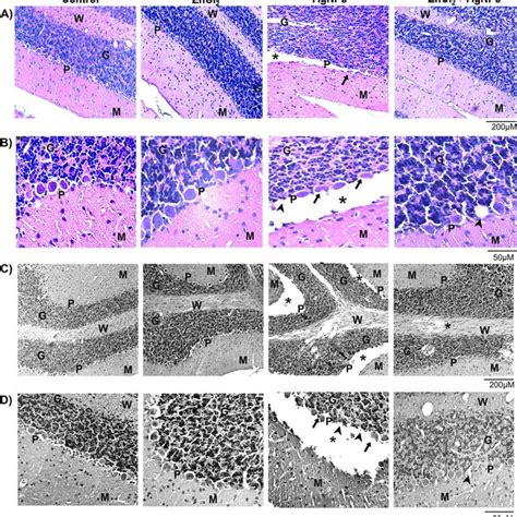 Silver Nanoparticles Agnps Characterization Micrographs Of Tem