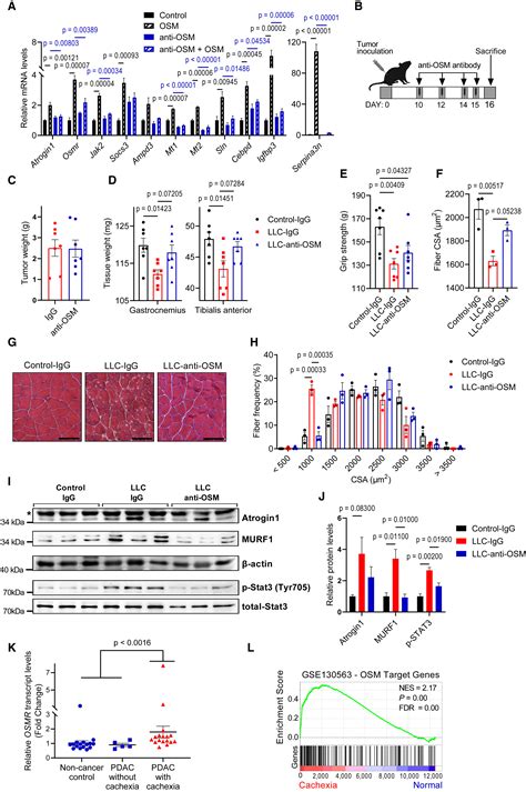 Oncostatin M Signaling Drives Cancer Associated Skeletal Muscle Wasting