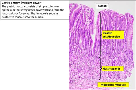 Stomach – Normal Histology – NUS Pathweb :: NUS Pathweb