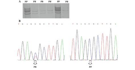 A Sscp Electrophoresis Pattern Of Gdf10 Gene Exon3 12495 Bp Locus B