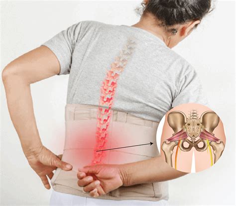 Lumbarisation and Sacralisation | Symptoms | Treatment | Qi Spine