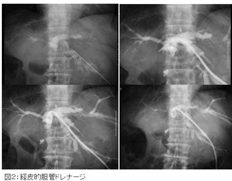 超音波検査を用いた診断・治療｜診療部 消化器内科｜明石医療センター