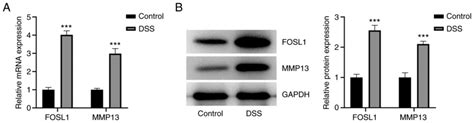 FOSL1 Knockdown Ameliorates DSSinduced Inflammation And Barrier Damage