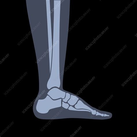 Foot and lower leg bones, illustration - Stock Image - F037/7863 ...