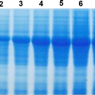 Sds Page Analysis Of Xhis Gklip In E Coli Bl De M Protein