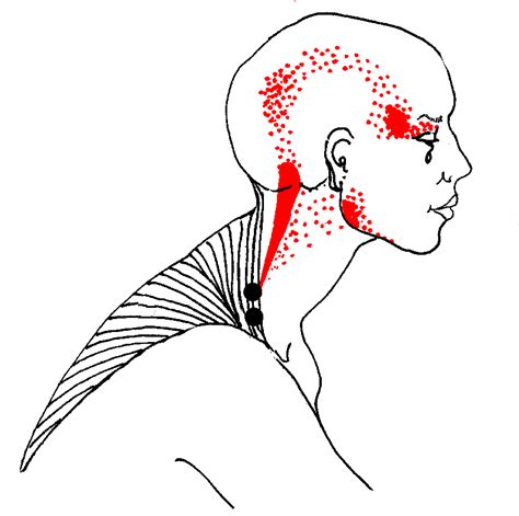 Common and rare diseases in head & neck: Pain in Head & Neck