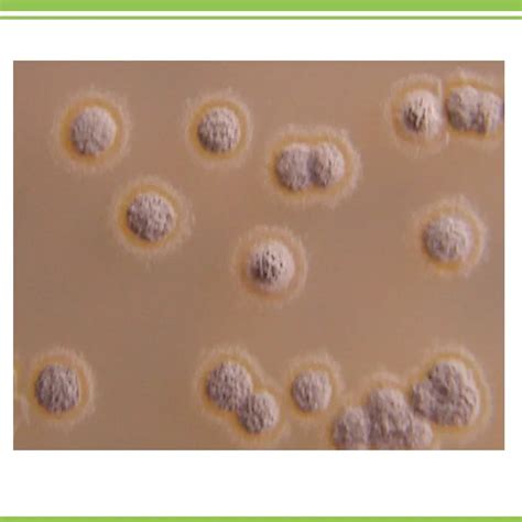 Actinomyces treatment antibiotics