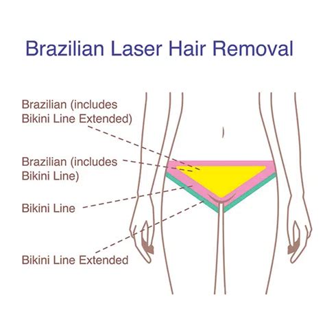 Extended Bikini Laser Hair Removal Deals Centralcountiesservices Org