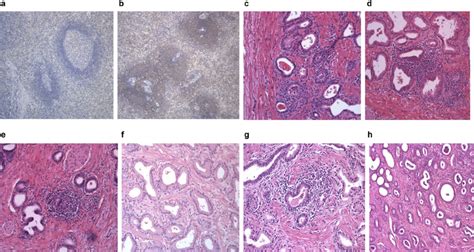 Histological Analysis Of Xmrv Infected Monkeys In Spleen And Prostate