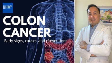 Colon Cancer Early Signs Causes And Prevention Youtube