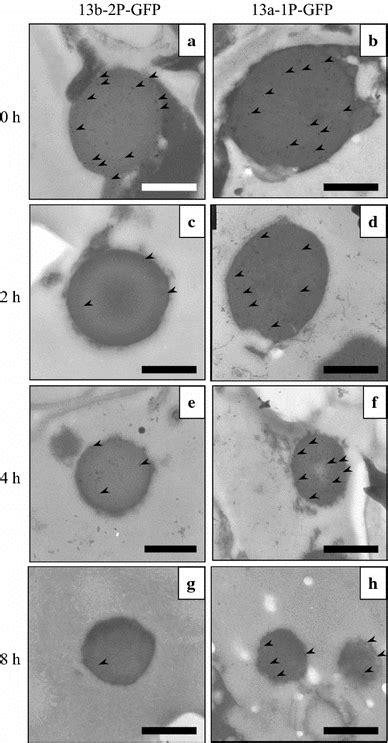 Immuno Transmission Electron Microscopy Of The Pb Is After In Vitro