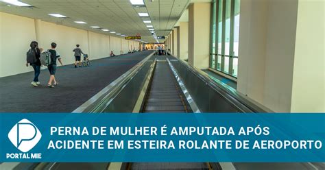 Mulher tem perna amputada após acidente em esteira rolante de aeroporto