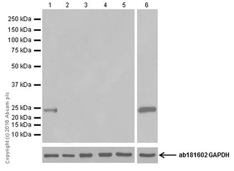 Anti Prolactin PRL Antibody EPR19386 AB183967 Abcam