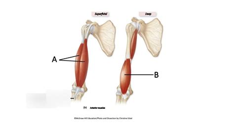 brachial Diagram | Quizlet