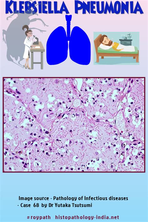 Pathology of Klebsiella Pneumoniae Infection (Klebsiella Pneumonia) | Klebsiella pneumoniae ...