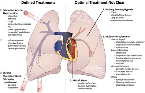 Pulmonary Hypertension In Patients With Heart Failure And Preserved