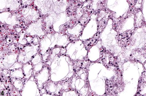 Lung Epithelium Necrosis Nonneoplastic Lesion Atlas