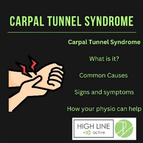 Carpal Tunnel Syndrome What Is It And How Can Your Physio Can Help